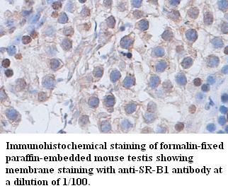 Anti- SR-B1 Antibody