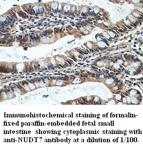 Anti-NUDT7 Antibody