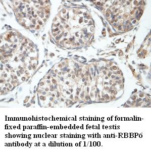 Anti-RBBP6 Antibody