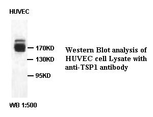 Anti-TSP1 Antibody