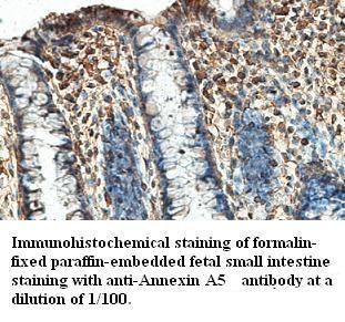 Anti-Annexin A5 Antibody