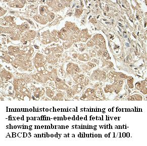 Anti-ABCD3 Antibody