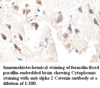 Anti- alpha 2 Catenin Antibody