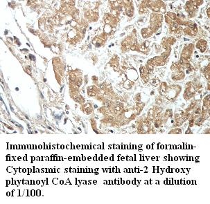 Anti- 2-hydroxyacyl-CoA lyase 1 Antibody