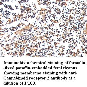 Anti- Cannabinoid receptor 2 Antibody