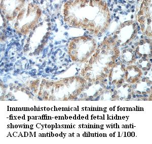 Anti-ACADM Antibody