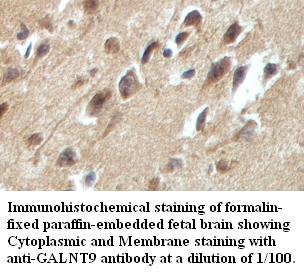 Anti-GALNT9 Antibody