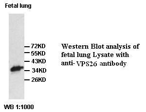 Anti-VPS26 Antibody