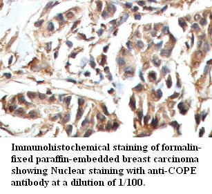 Anti-COPE Antibody