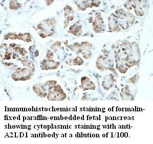 Anti-A2LD1 Antibody