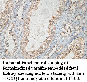 Anti-FOXQ1 Antibody