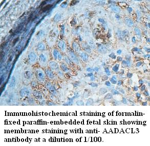 Anti-AADACL3 Antibody