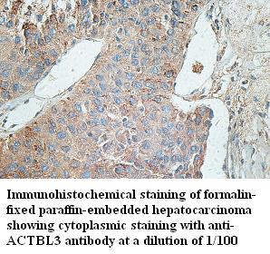 Anti-ACTBL3 Antibody