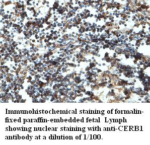 Anti-CERB1 Antibody