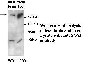 Anti-SOS1 Antibody