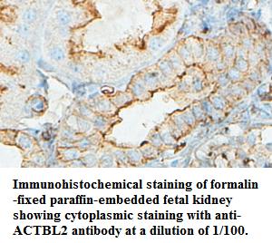 Anti-ACTBL2 Antibody