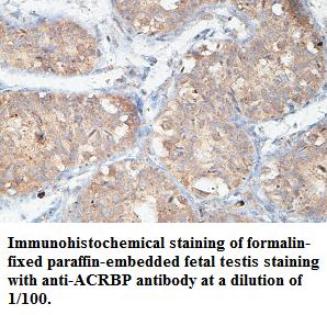 Anti-ACRBP Antibody