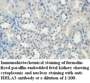 Anti-HHLA3 Antibody