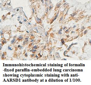 Anti-AARSD1 Antibody