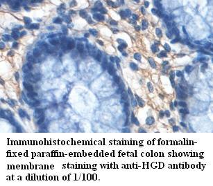 Anti-HGD Antibody