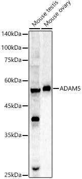 Anti-ADAM5 Antibody