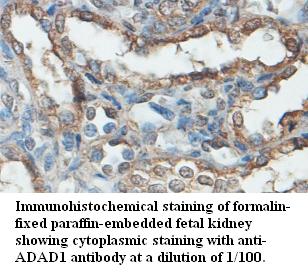 Anti-ADAD1 Antibody