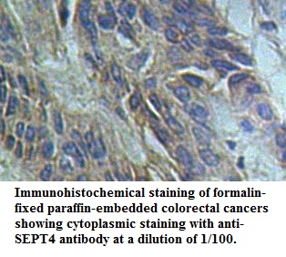 Anti-SEPT4 Antibody