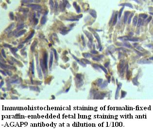 Anti-AGAP9 Antibody