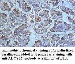 Anti-AHCYL2 Antibody