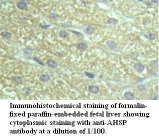 Anti-AHSP Antibody