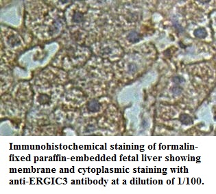 Anti-ERGIC3 Antibody