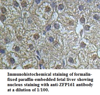 Anti-ZFP161 Antibody