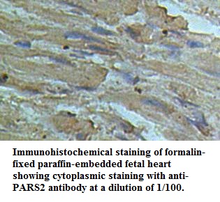 Anti-PARS2 Antibody