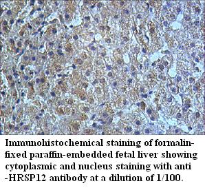 Anti-HRSP12 Antibody