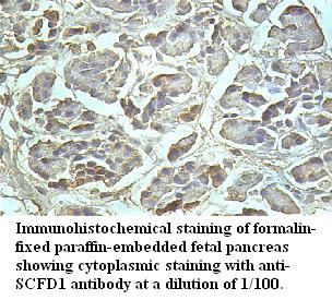 Anti-SCFD1 Antibody