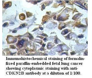 Anti-CDKN2B Antibody