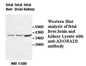 Anti-ADORA2B Antibody