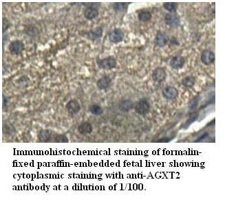 Anti-AGXT2 Antibody