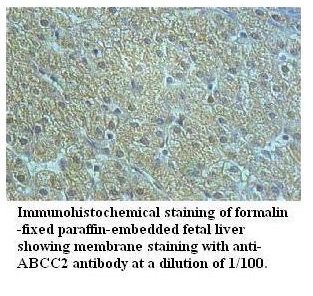 Anti-ABCC2 Antibody