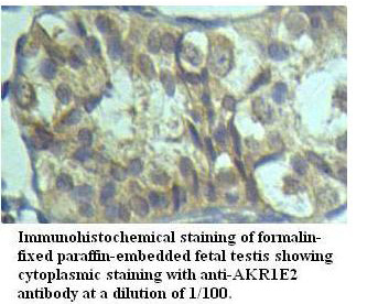 Anti-AKR1E2 Antibody