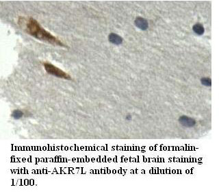 Anti-AKR7L Antibody