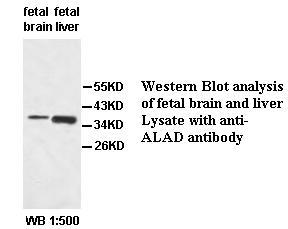 Anti-ALAD Antibody