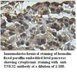 Anti-TNKS2 Antibody