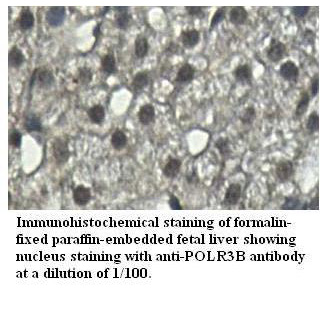 Anti-POLR3B Antibody
