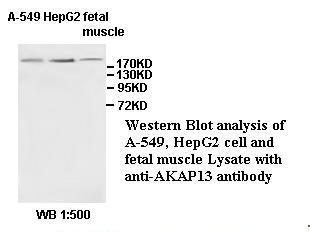 Anti-AKAP13 Antibody