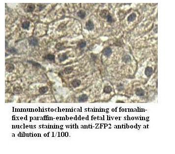 Anti-ZFP2 Antibody
