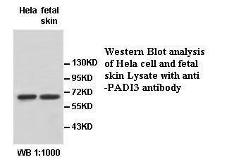 Anti-PADI3 Antibody