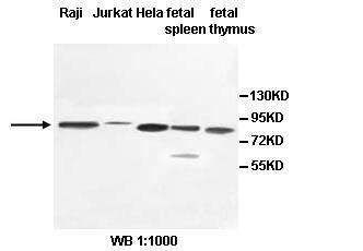 Anti-PCIF1 Antibody