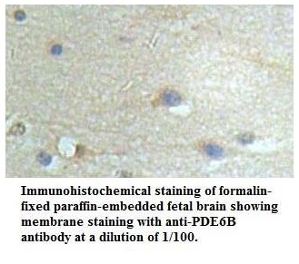 Anti-PDE6B Antibody