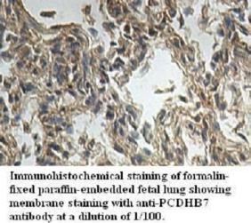 Anti-PCDHB7 Antibody